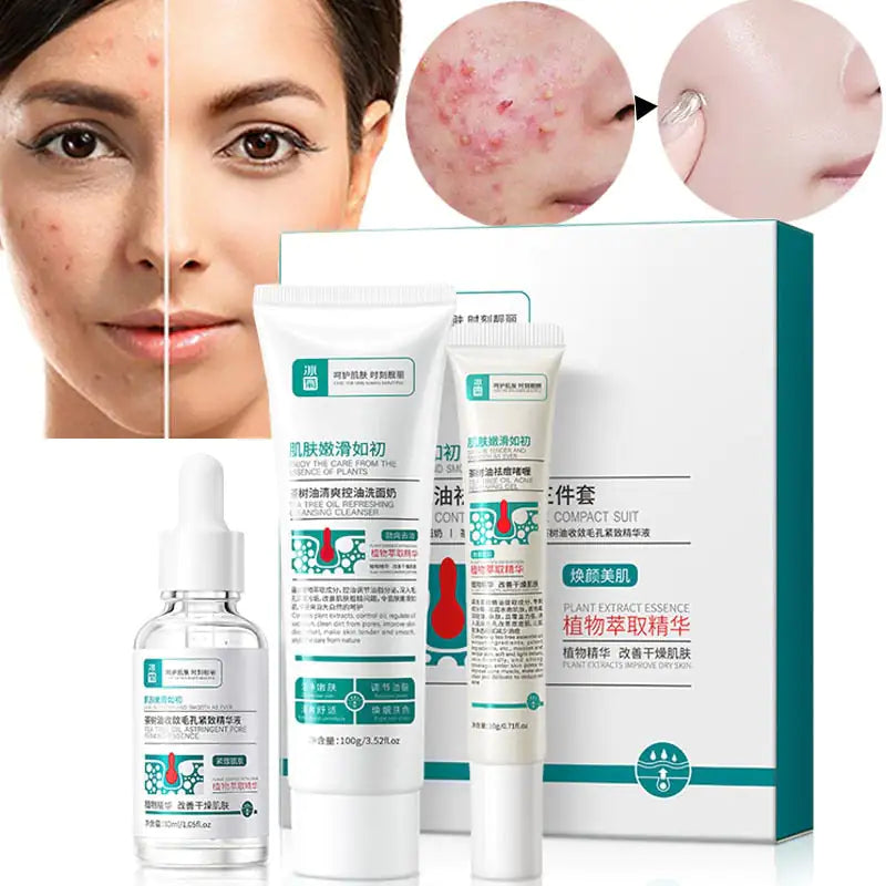 Clear Skin Acne Care Moisturizing Kit