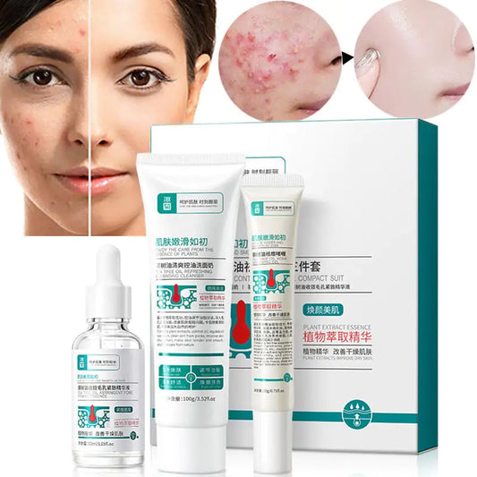 Clear Skin Acne Care Moisturizing Kit